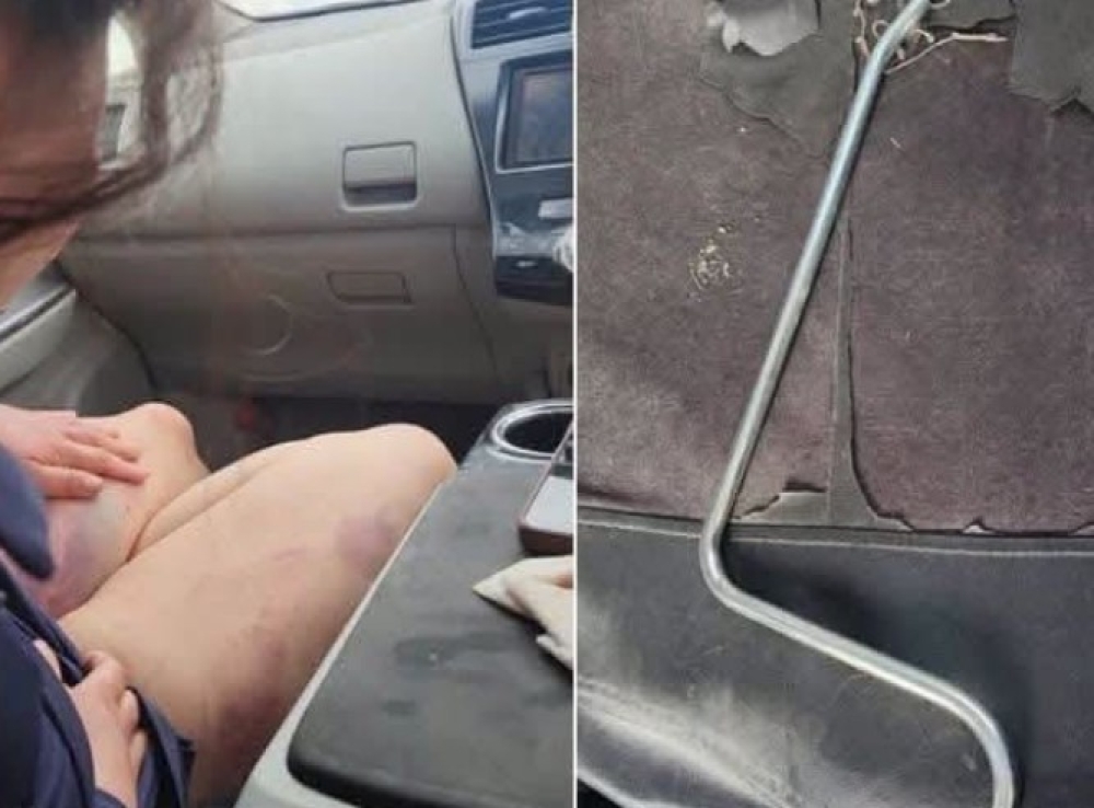 Салсан эхнэрээ зодож гэмтээсэн этгээдийг саатуулжээ